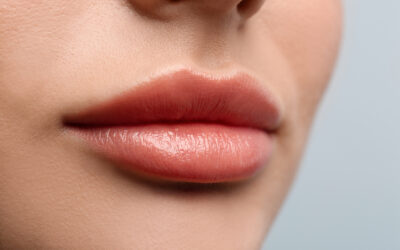 5 Tips for Luscious Lips from Dentist in Lombard